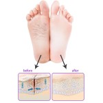 Exfoliating Foot Peel Factory - Most Selling Premium Soothing Relief Sheet
