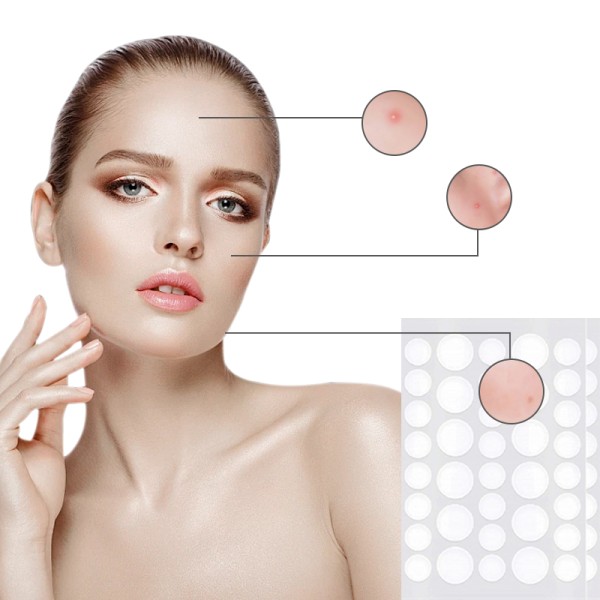 Private Label Acne Patch Manufacturer - Problem-Solving Nasal Body Removal