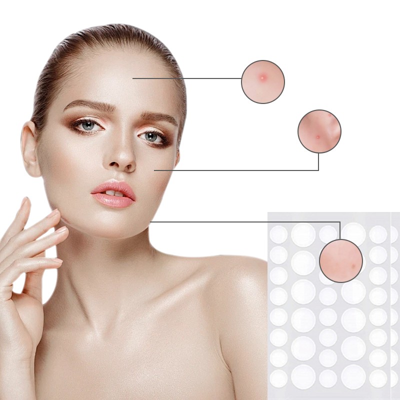 Private Label Acne Patch Manufacturer - Problem-Solving Nasal Body Removal