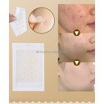 Hydrocolloid Pimple Patch Supplier - New Trending for Covering Zits Mouth