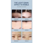 Microneedle Anti-Wrinkle Patches Supplier - Hot Selling Reusable Forehead