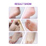 Skin Moisturizing Foot Mask Factory - 2024 Hot Selling Exfoliating Mask