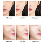 Korean Lifting Mask Factory - V-Shape Face Slimming Healthcare Supply