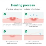 Pimple Patch Supplier - Top Selling Self Care Dots for Spots Acne Cover