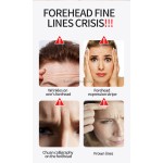 Microneedle Anti-Wrinkle Patches Supplier - Hot Selling Reusable Forehead