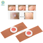 Corn Plaster Manufacturer - Salicylic Acid Callus Remover