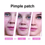 Acne Patch Kit Supplier - Customizable Sizes Refillable Eco-Friendly Reduced
