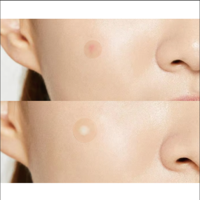 No-Mirror Patches Factory - Confidence Hide Heal Anytime Healthcare