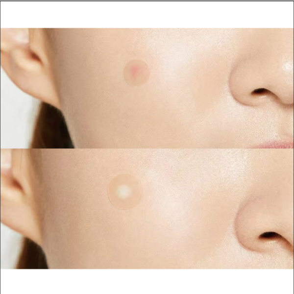 No-Mirror Patches Factory - Confidence Hide Heal Anytime Healthcare