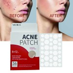 Acne Patch Kit Supplier - Customizable Sizes Refillable Eco-Friendly Reduced