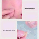 Eczema Control Patch Factory - Acne Control Eczema-Prone Skin Healthcare