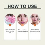 Acne Patch Manufacturer - Healthcare Supply Retain Highlights Skin Care