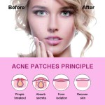 Confidence Patches Factory - No-Mirror Healing Convenient Anytime Use