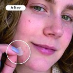 Confidence Patches Factory - No-Mirror Healing Convenient Anytime Use