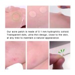 Eczema Control Patch Factory - Acne Control Eczema-Prone Skin Healthcare