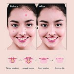 No-Mirror Patches Factory - Confidence Hide Heal Anytime Healthcare