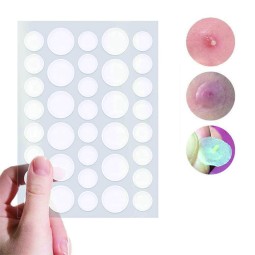 Acne Protection Patch Supplier - Effective Defect Control Healthcare Supply