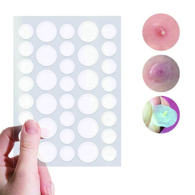 Acne Protection Patch Supplier - Effective Defect Control Healthcare Supply
