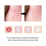 Acne Recovery Patch Manufacturer - Snow Grass Effective Bidding Farewell Acne