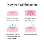 Acne Patch Manufacturer - Healthcare Supply Retain Highlights Skin Care