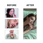 Vitamin Nasal Strips Factory - Uninterrupted Sleep Better Quality Reduces Snoring