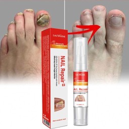 Foot Care Factory - Feet Care Anti Infection Paronychia Treatment