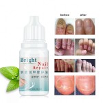 Nail Treatment Supplier - 10ml Anti Infection Nail Care Treatment