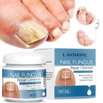 Nail Cream Manufacturer - Lanthome Nail Fungus Removal Cream