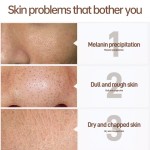 Whitening Cream Manufacturer - Face Whitening Lightening Spots Cream