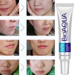 Face Cream Factory - For Bioaqua 30g Anti-Acne Scar Remover