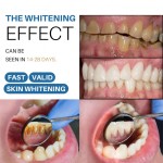 Teeth Whitener Manufacturer - Tooth Gel Whitener Bleach Stains Removal