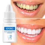 Teeth Whitening Gel Supplier - Multi-Purpose Organic Plaque Removal