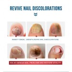 Nail Serum Factory - Natural Foot Hand Toe Fungus Removal