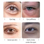 Face Cream Supplier - Lanthome Whitening Oil Acne Scar Removal