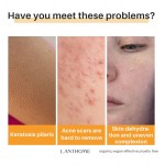 Handmade Soap Factory - Oem Goat Milk Carrot Papaya Natural Soap