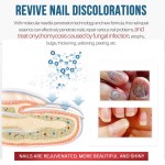 Nail Serum Factory - Natural Foot Hand Toe Fungus Removal