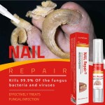 Foot Care Factory - Feet Care Anti Infection Paronychia Treatment