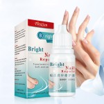 Nail Treatment Supplier - 10ml Anti Infection Nail Care Treatment