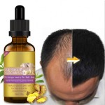 Hair Oil Manufacturer - Anti Loss Ginger Rosemary Vitamin E Care