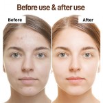 Whitening Cream Manufacturer - Face Whitening Lightening Spots Cream