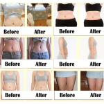 Slimming Patch Manufacturer - Belly Fat Burning Herbal Diet Patch