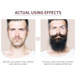 Beard Growth Serum Manufacturer - Anti Hair Loss Thicker Hair Serum