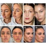 PDO Threads Manufacturer - 4D L Cannula 19G 100MM Facial Threads