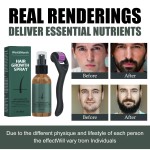 Beard Growth Spray Factory - Natural Organic Essential Oil Kit