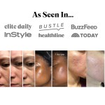 Derma Pen Manufacturer - Rechargeable Nano Needling Skin Care