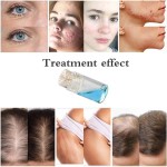 Microneedling Pen Manufacturer - 24k Gold Hydra Stamp Home Use