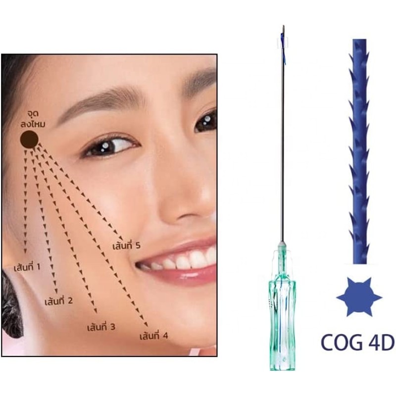 PDO Threads Manufacturer - 4D L Cannula 19G 100MM Facial Threads