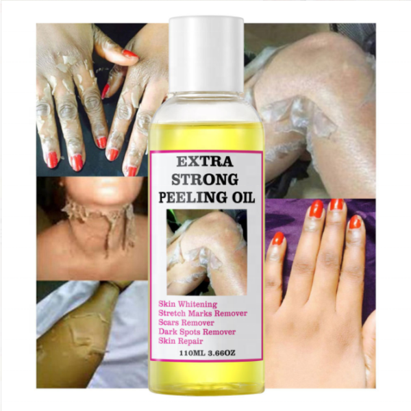 Peeling Oil Supplier - Vitamin C Knuckle Whitening Dark Spot Care