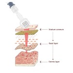 Derma Roller Supplier - OEM Microneedling Serum Applicator Roller