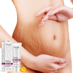 Stretch Mark Cream Manufacturer - Mango Stretch Mark Cream Pregnancy Repair Scar